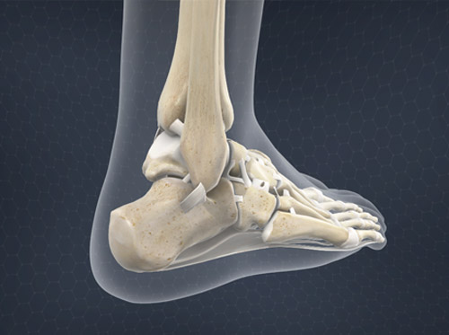 Video - Ankle Sprains - HealthClips Online