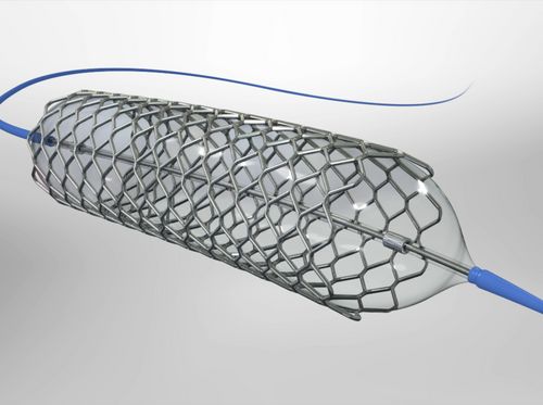 Thumbnail image for "Cardiovascular Stent Placement"