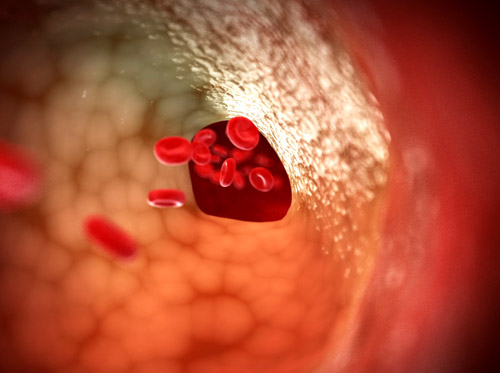 Thumbnail image for "Coronary Heart Disease (Coronary Artery Disease)"