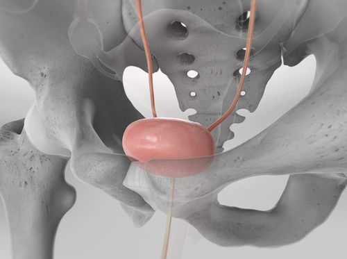 Thumbnail image for "La cistectomía radical (asistida por robot)"