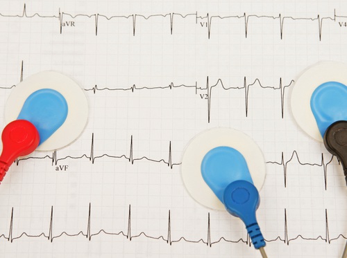 Thumbnail image for "Electrocardiografía (ECG, EKG)"