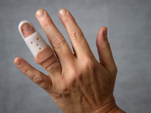 Video - Finger Fracture - HealthClips Online