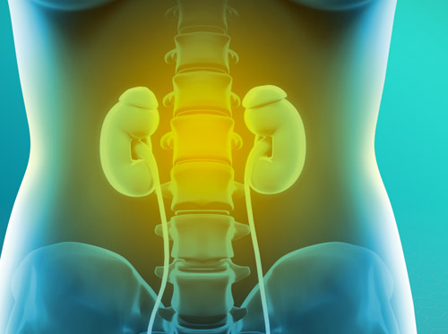 Thumbnail image for "Kidney Failure (Renal Failure)"