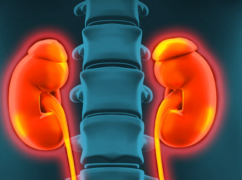 Thumbnail image for "Kidney Infection (Pyelonephritis)"