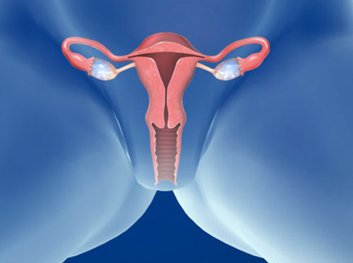 Thumbnail image for "Menstrual Cramps (Dysmenorrhea)"
