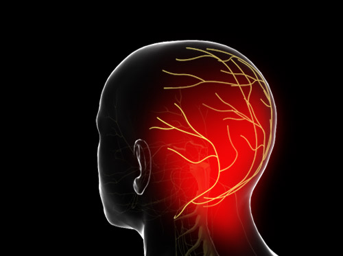 Thumbnail image for "Neuralgia occipital (neuralgia de Arnold)"