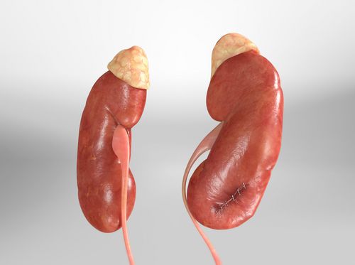 Thumbnail image for "Nefrectomía parcial (asistida por robot)"