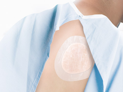 Thumbnail image for "Tratamiento de la úlcera por presión"