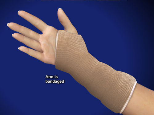 Video Distal Radius Fracture Repair With Volar Plate Healthclips Online