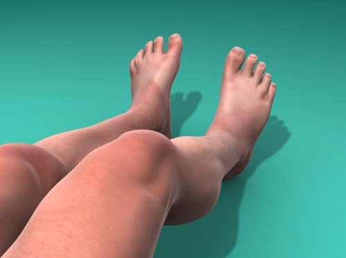 Thumbnail image for "Restless Legs Syndrome (RLS)"