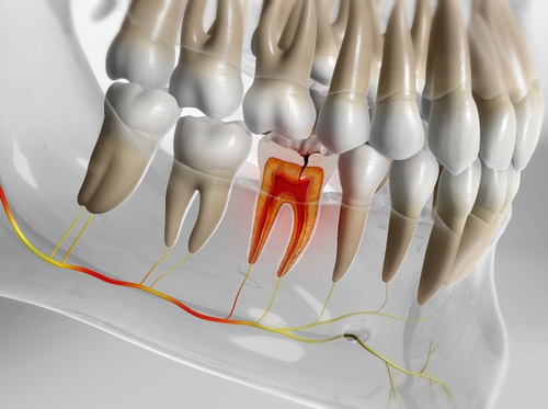 Thumbnail image for "Sensitive teeth"