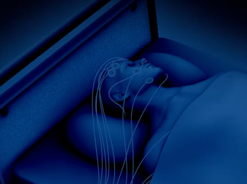 Thumbnail image for "Sleep Study (Polysomnography)"