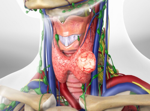 Thumbnail image for "Thyroid Nodule"
