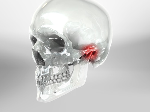 Thumbnail image for "Trastornos de la articulación temporomandibular (ATM)"