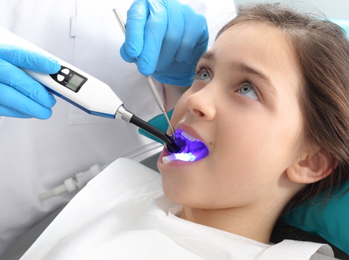 Thumbnail image for "Selladores dentales"