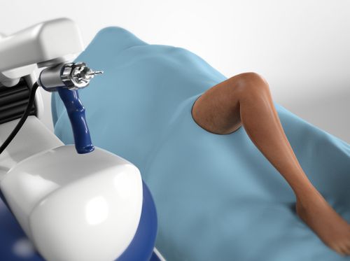 Thumbnail image for "Partial Knee Replacement (Robotic-Arm Assisted Method)"