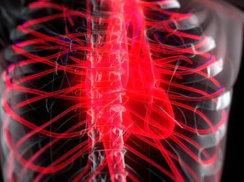 Thumbnail image for "Cardiac Arrest"