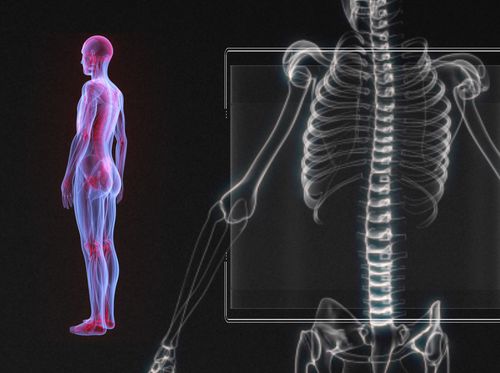 Thumbnail image for "Osteopenia"